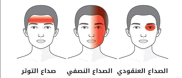 علاج الصداع